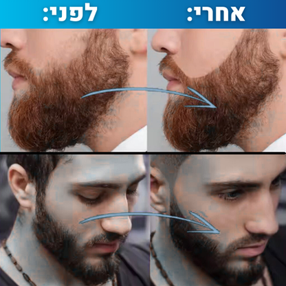 עט למילוי הזקן
